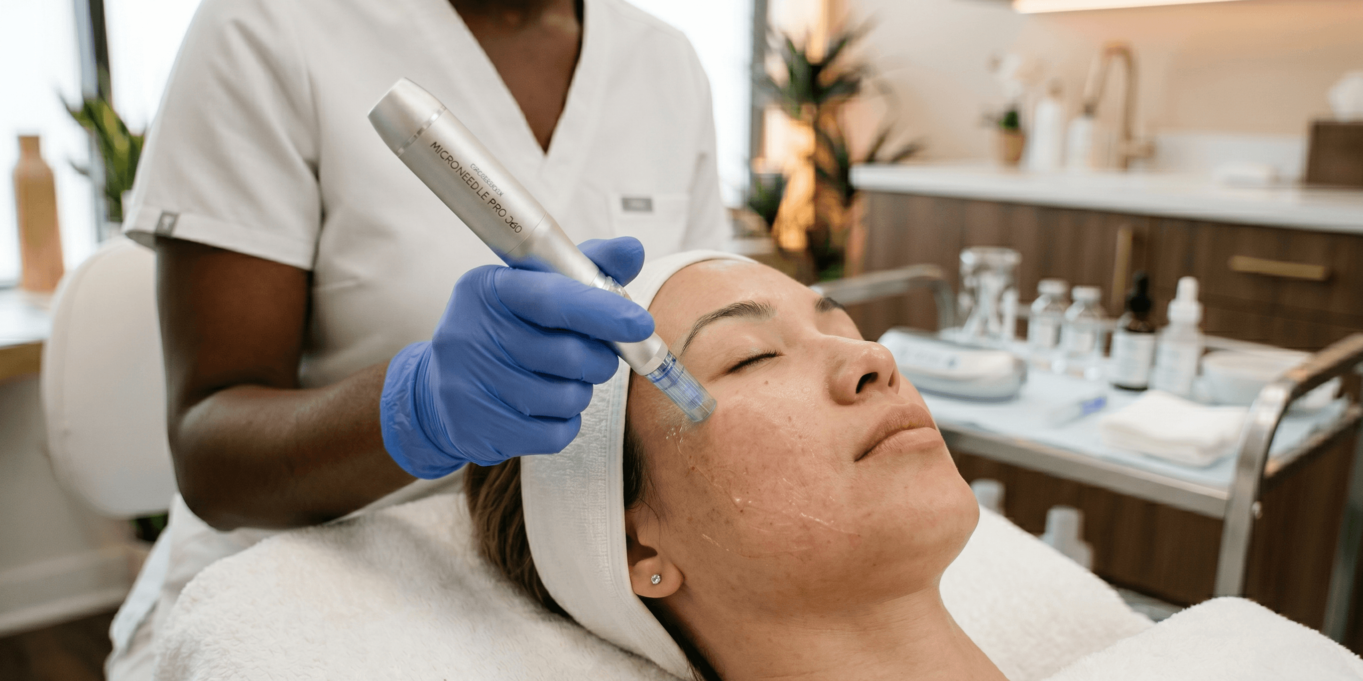 RF Microneedling at LovMedSpa