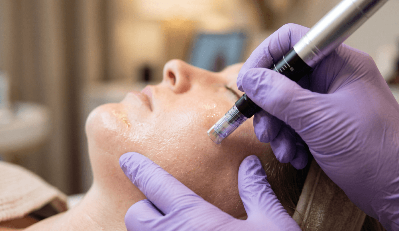 Full Face PRP Rejuvenation — Regenerative Therapy at LovMedSpa