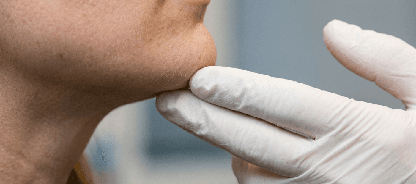 Jawline Filler — Jawline Definition at LovMedSpa