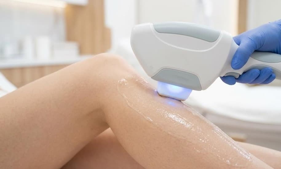 Laser hair removal at LovMedSpa