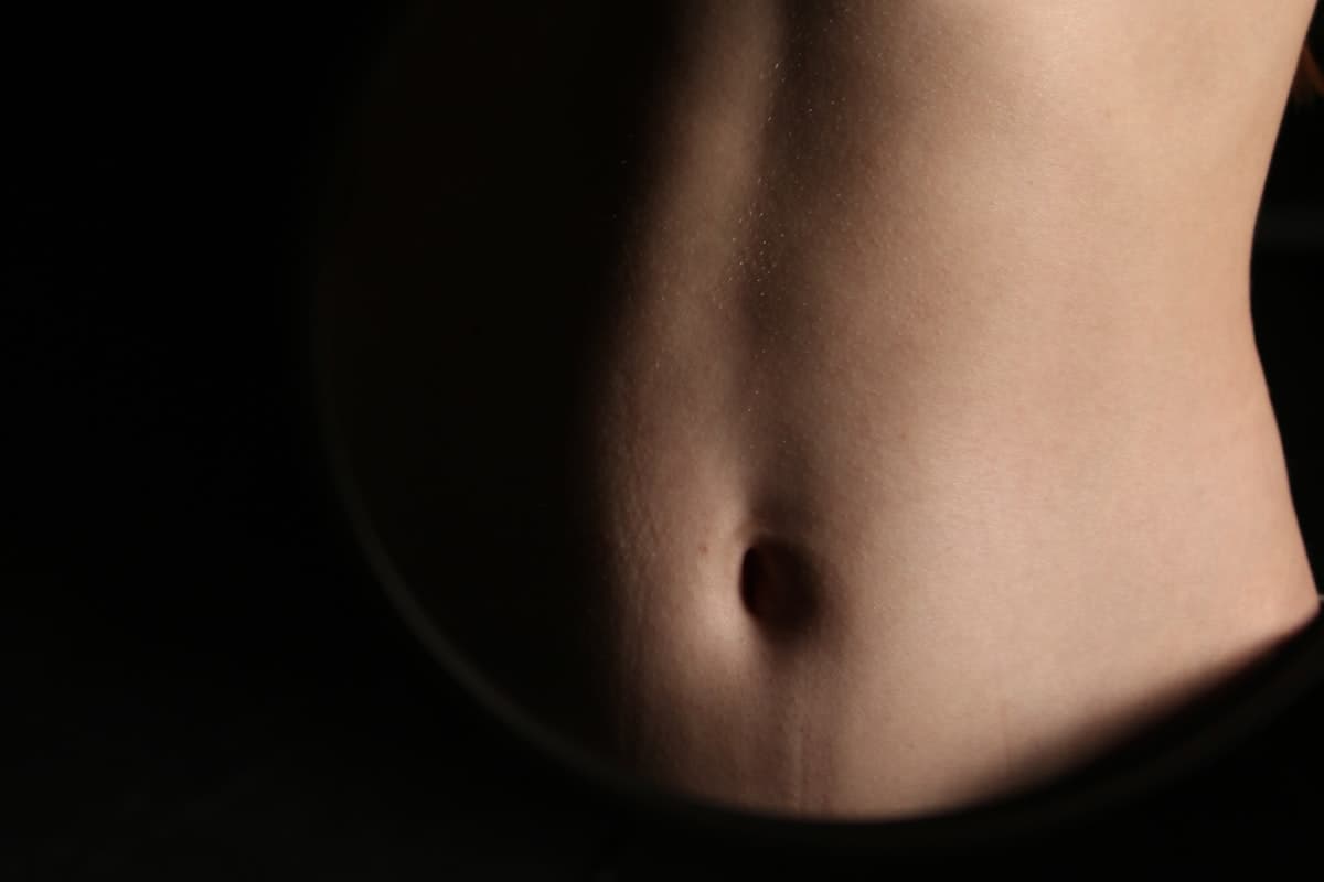 Laser Liposuction — BeautiFill Laser Lipo · Staten Island Only at LovMedSpa