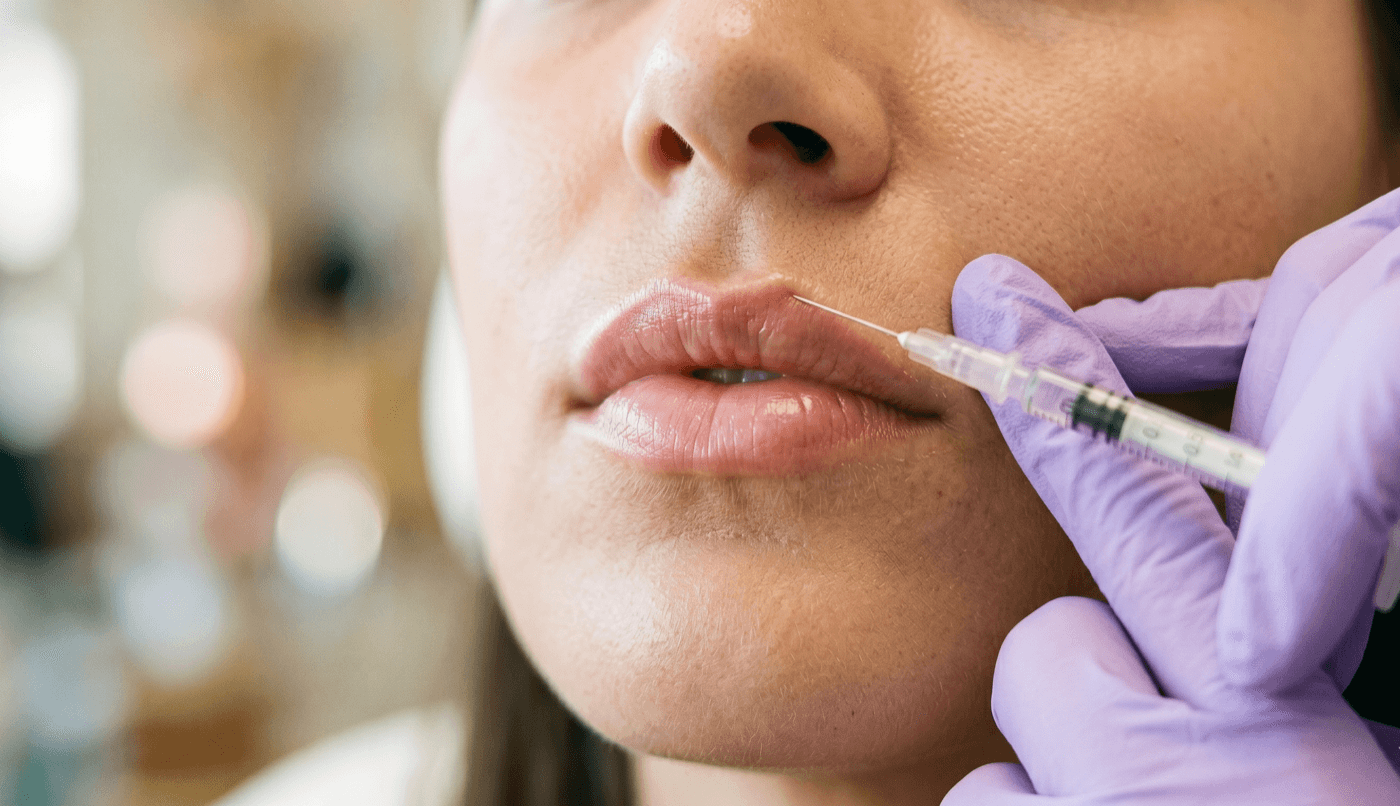 Lip flip treatment at LovMedSpa