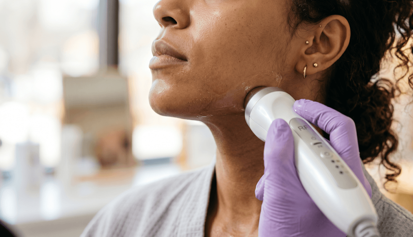 Quantum RF Jawline Sculpt — Face Contouring at LovMedSpa