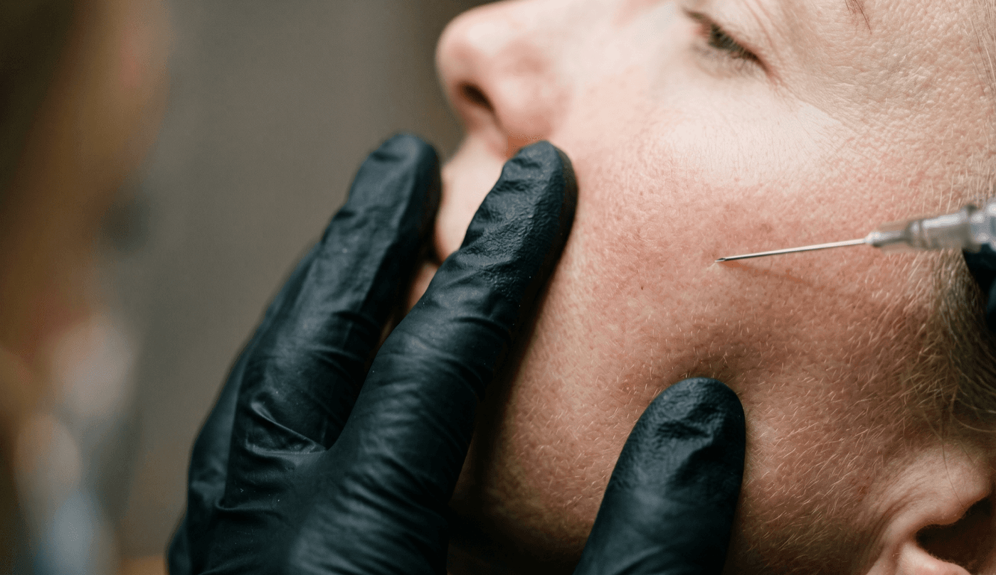 Sculptra — Collagen Stimulation at LovMedSpa